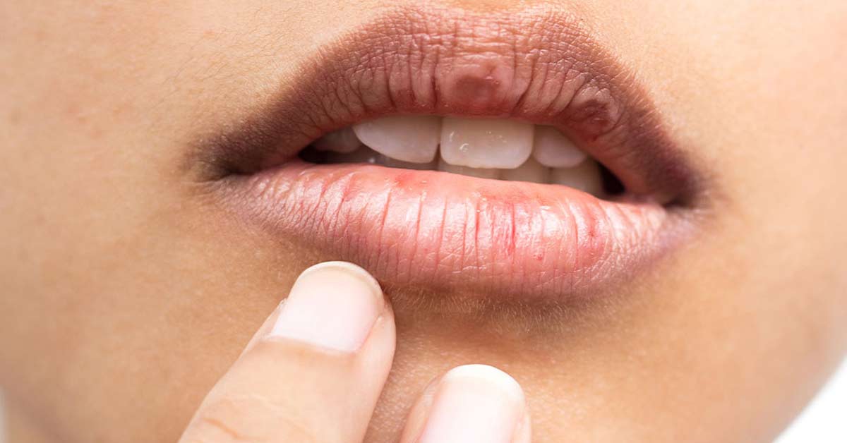 Autoexame da boca com inspeção dos lábios e da mucosa oral